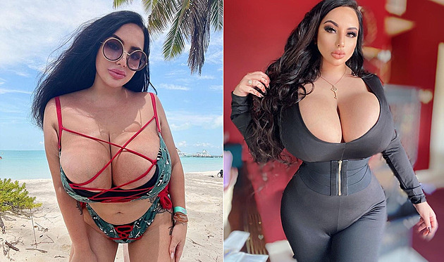 Nezmenšujte si ňadra, vzkazuje modelka, která kvůli nim roky trpěla