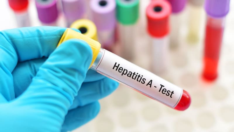 Žloutenkou se loni nakazilo pětkrát víc lidí než o rok dřív. Šíří se však i další infekce